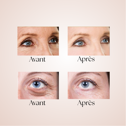 Patchs Micro-aiguilles Réparateurs et Anti-Âge